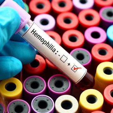El 70 % de los peruanos con hemofilia no tendría diagnóstico ni un tratamiento oportuno