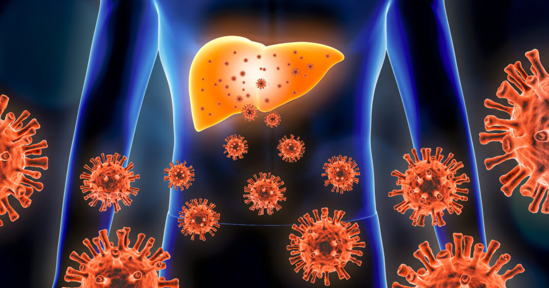 Hepatitis 3d rendering illustration with red virus cells and human body. Viral, infectious and inflammatory hepatic or liver disease, medical and healthcare concepts. Hepatitis: la infección que avanza en silencio y puede ser mortal